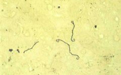leptospiroz