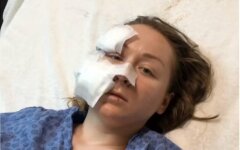 Анна Бутим, На украинку напали в Турции, Украинка в Турции