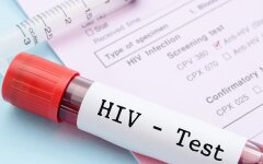 Тест на ВИЧ