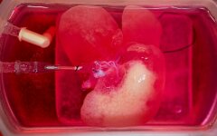 печень почти