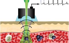 кровь клетки