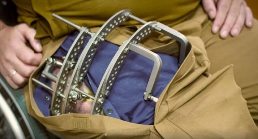 Адаптивний одяг