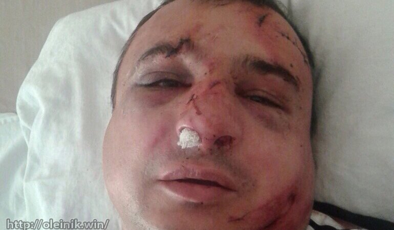 арсен клинчаев