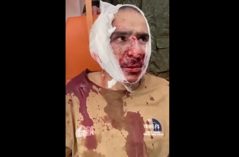 В РФ опубликовали шокирующее видео с "пленным террористом": отрезали ухо и заставили съесть