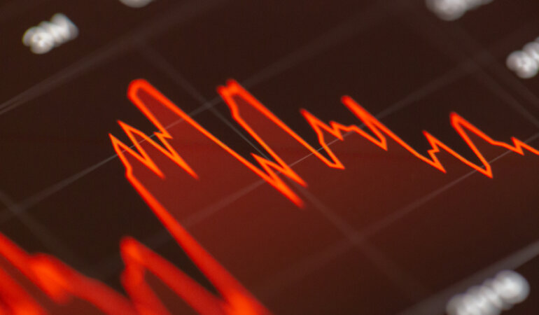 экономический рост