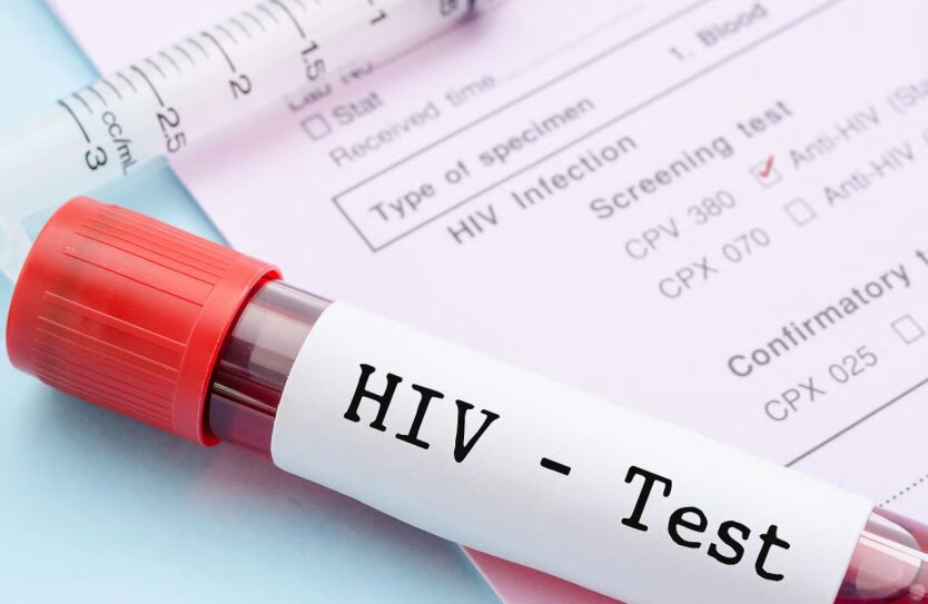 Тест на ВІЛ