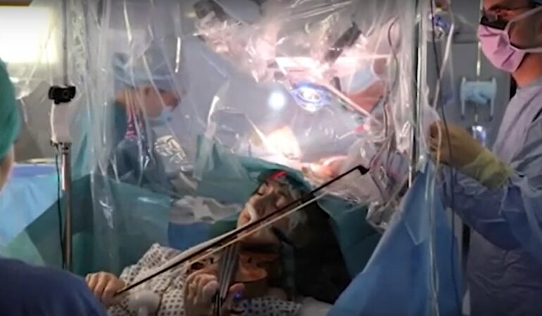 операция на мозге