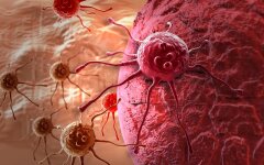 cancer cell