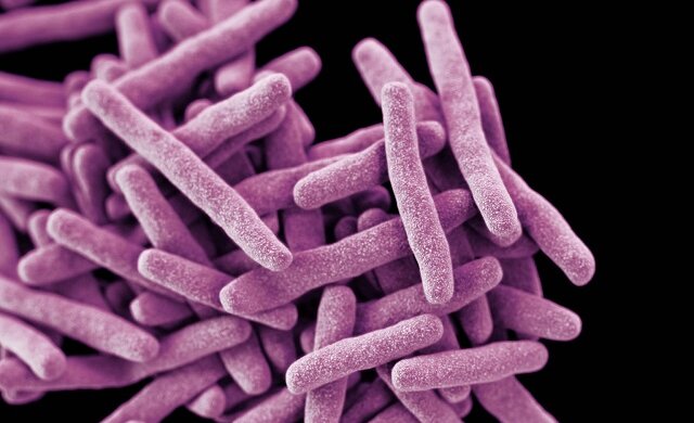 Искусственный интеллект создал препараты против туберкулеза