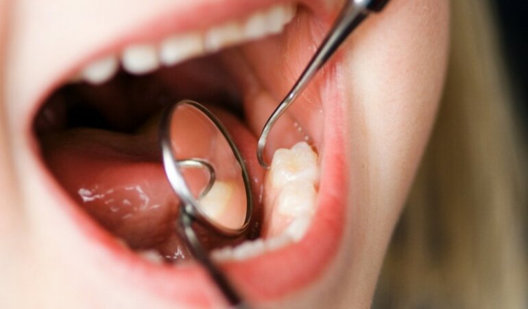 Child Dental Check-Up