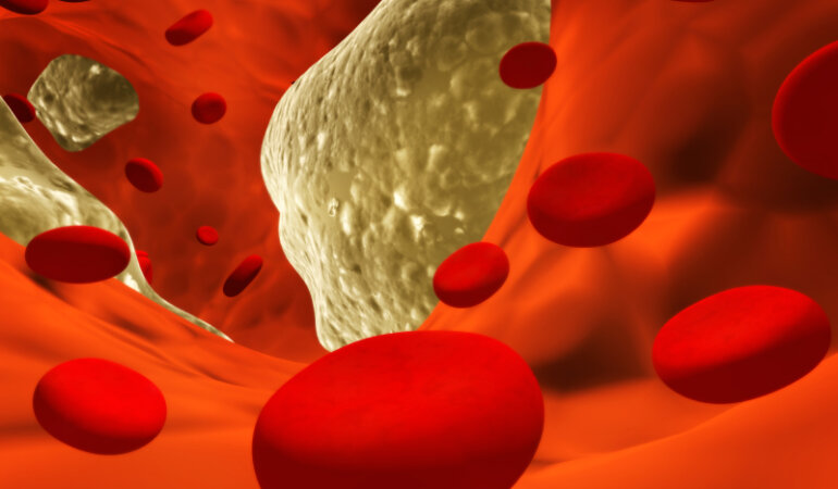 холестерин