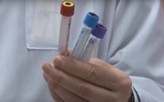 исследование коронавируса, Нидерланды, коронавирусная инфекция, изучение коронавируса