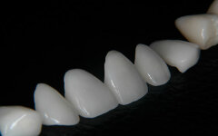 veneer
