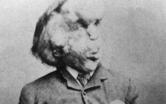 человек-слон