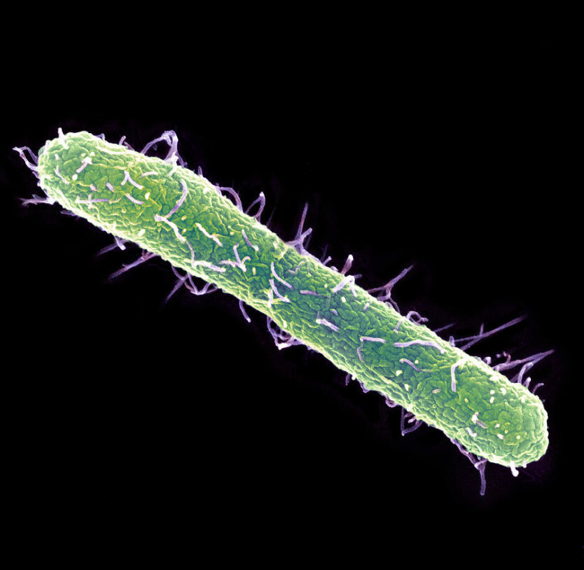 salmonella-typhimurium-bacterium-sem-