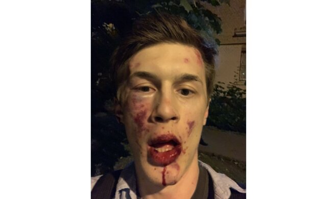В Москве избили известного оппозиционного активиста: фото