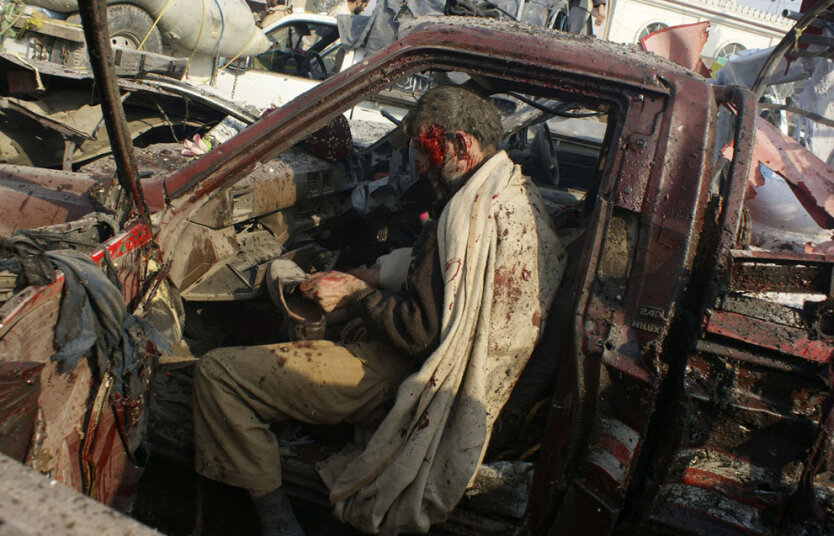 10 января 2012. Пешавар, Пакистан. Человек, раненный во время взрыва, надевает свою обувь перед тем, как его заберут в больницу