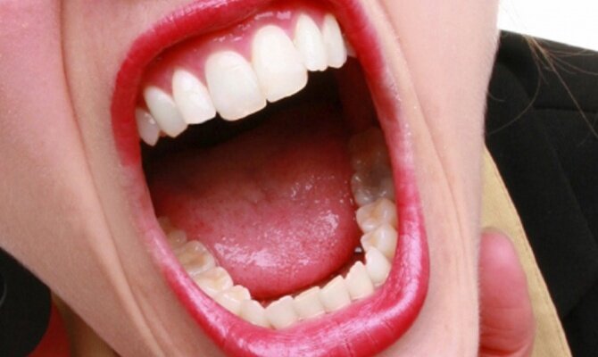 укус крик женщина