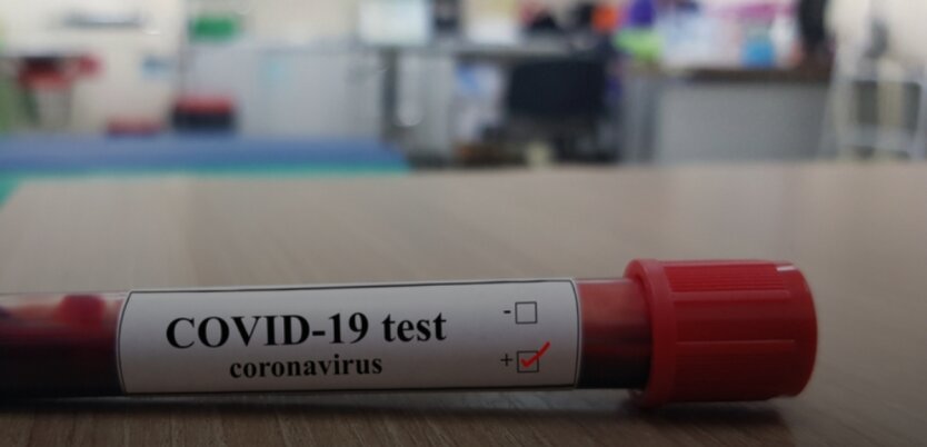 тест на коронавирус, коронавирус-тест