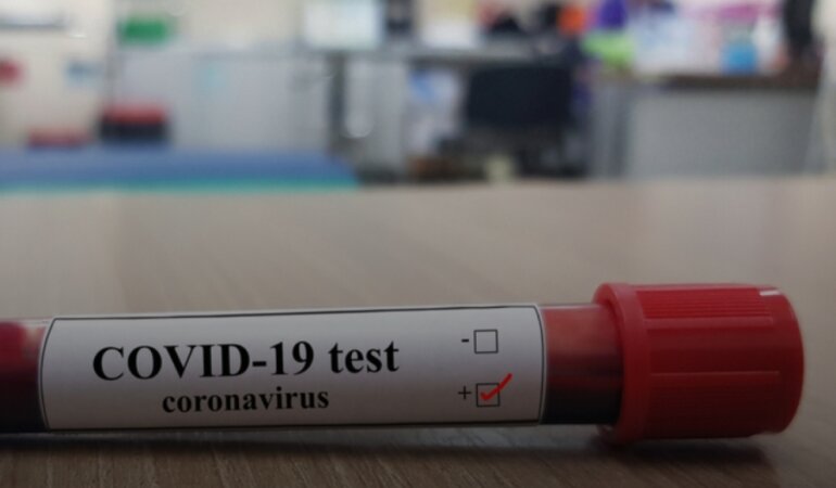 тест на коронавирус, коронавирус-тест