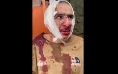 В РФ опубликовали шокирующее видео с "пленным террористом": отрезали ухо и заставили съесть