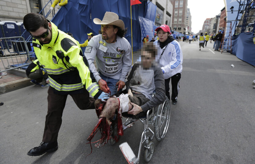 Медработники увозят тяжело раненого мужчину для оказания помощи. (AP Photo/Charles Krupa)  