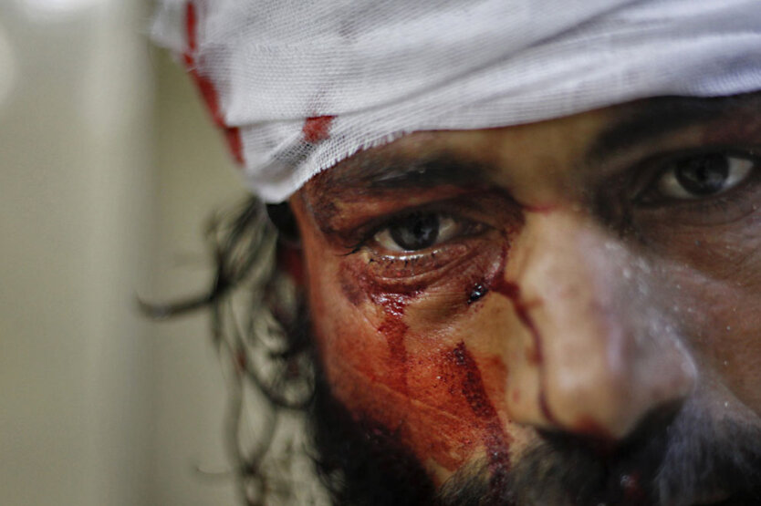 Раненный в боях в Алеппо