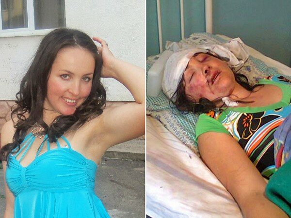 Жертве милиционеров-насильников нужна дорогостоящая операция