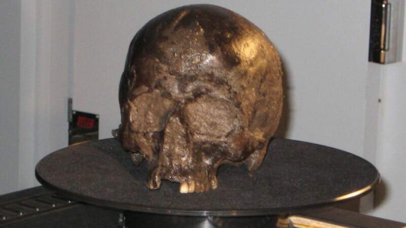 железо-возрастное череп.
