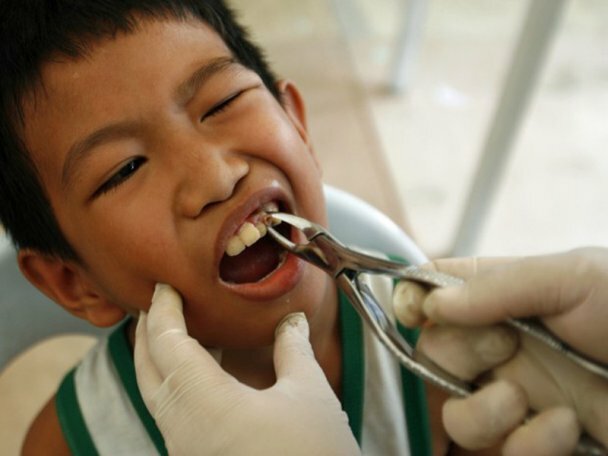 5. Мальчику удаляют зуб в ходе рекордного стоматологического обследования в трущобах Манилы. Здесь был установлен рекорд по наибольшему количеству обслуженных пациентов за 24 часа. (bigpicture.ru)