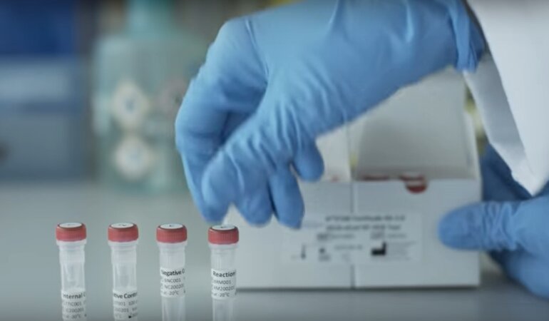 коронавирус, тест на коронавирус