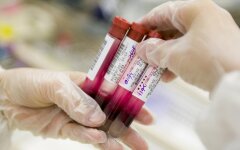 Blood Investigation