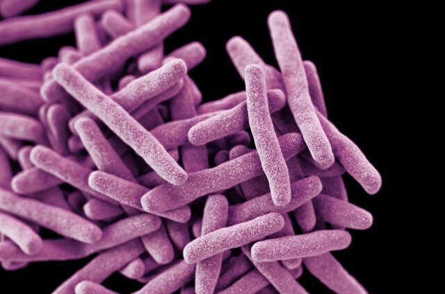 Искусственный интеллект создал препараты против туберкулеза