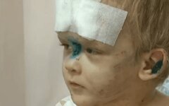 избитый малыш