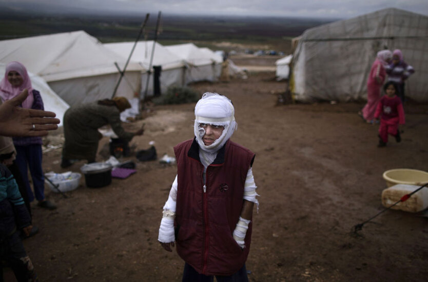 Десятилетний Абдулла Ахмед, обгоревший в результате авиаудара правительственных сил, стоит возле палатки в лагере для беженцев возле деревни Атмех. 