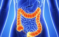 рак кишечника