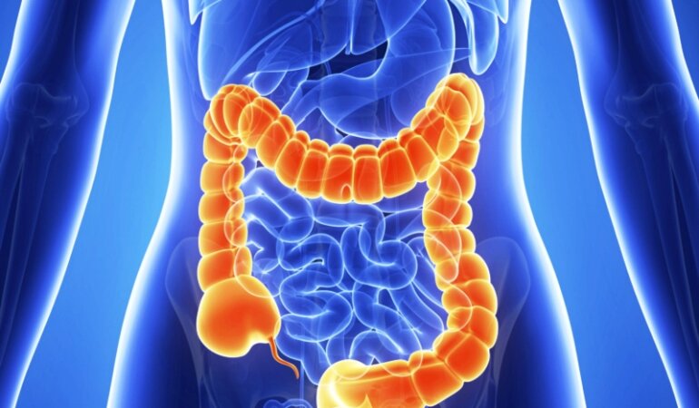 рак кишечника