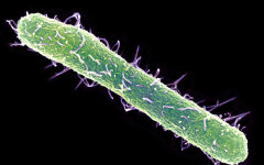 salmonella-typhimurium-bacterium-sem-