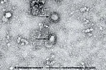 вирус SARS-CoV-2