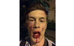В Москве избили известного оппозиционного активиста: фото