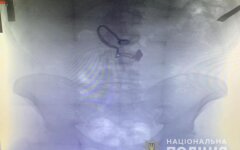 рентген цепочка