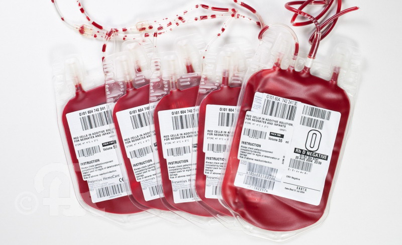 Группа крови и ее переливание. Пакет с кровью для переливания.